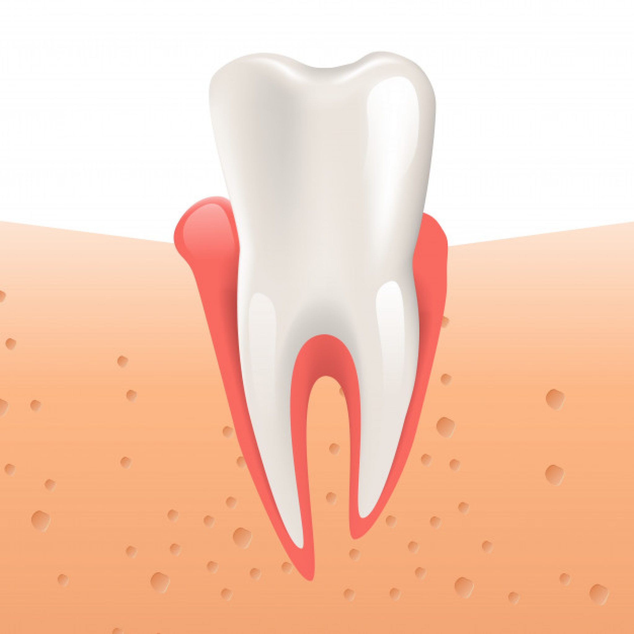 Arracher une dent Procédure, cicatrisation et complications Centre dentaire colombes Valmy